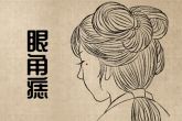 面部哪些痣必须点掉图解 眉毛中间有恶痣